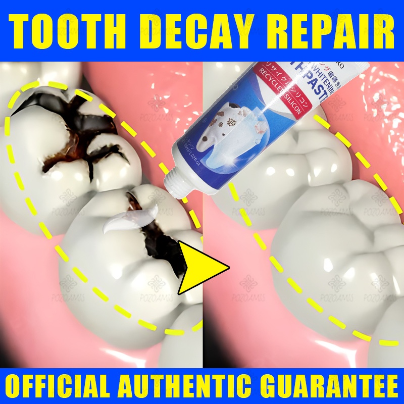 Whiten Toothpaste Dazzling White And Bad Breath Removal Fresh Breath ...