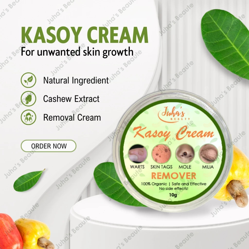 Kasoy Cream Remover 100% Original 5g and 50g | Warts Remover | Skin Tag ...