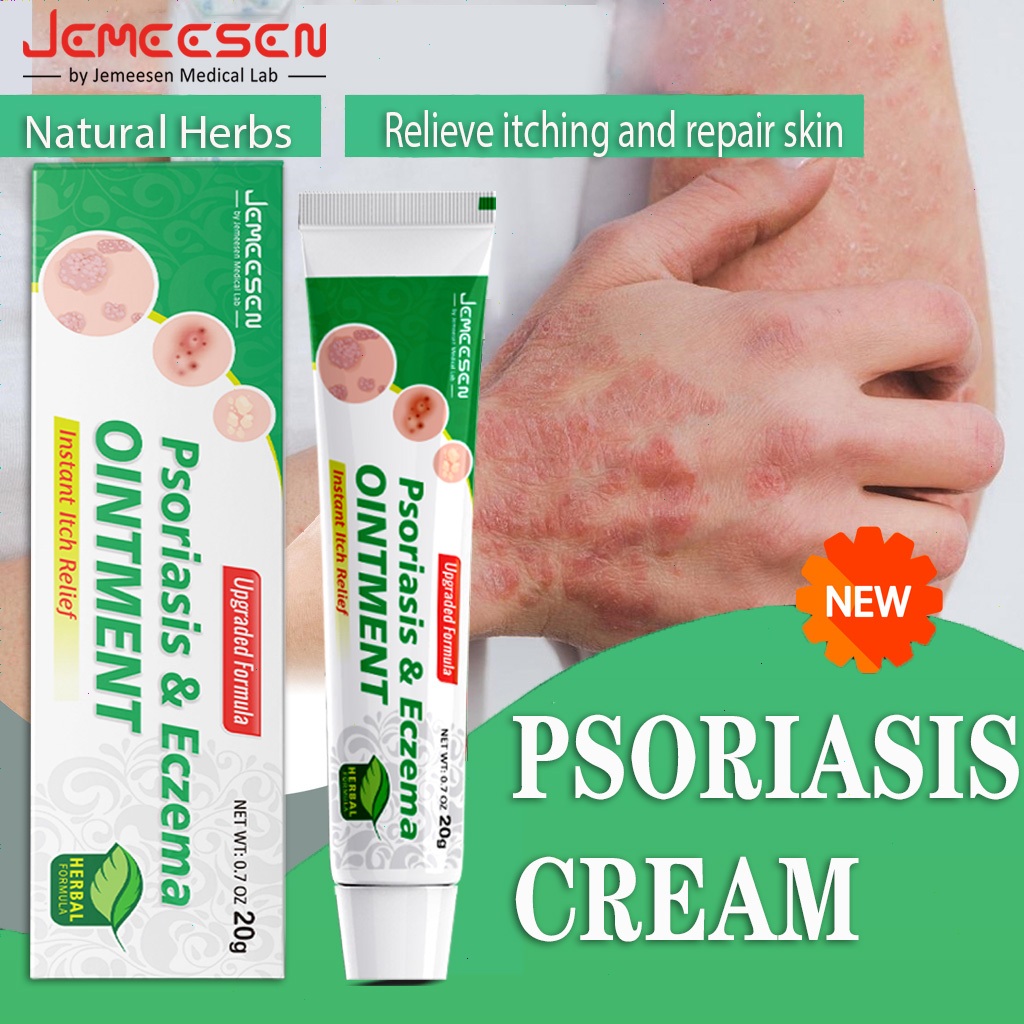 Jemeesen Psoriasis Cream Gamot Sa Kati Kati Sa Balat Ointment For Skin ...