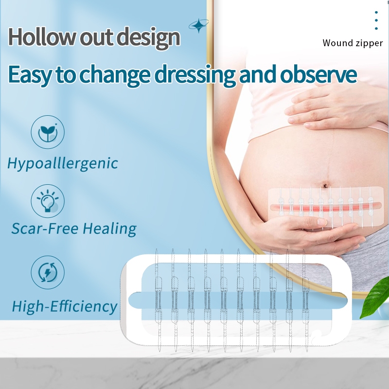 Wound Closure Strip Zip Stitch Emergency Laceration Closure Kit ...