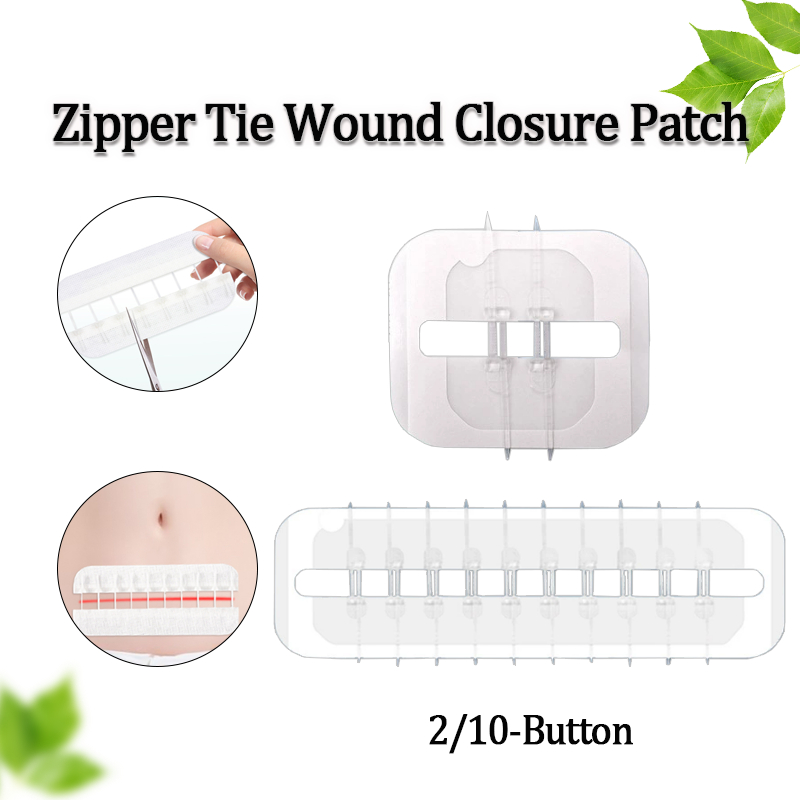 Wound Closure Patch Wound Quick Suture Medical Zipper Band-Aid Outdoor ...