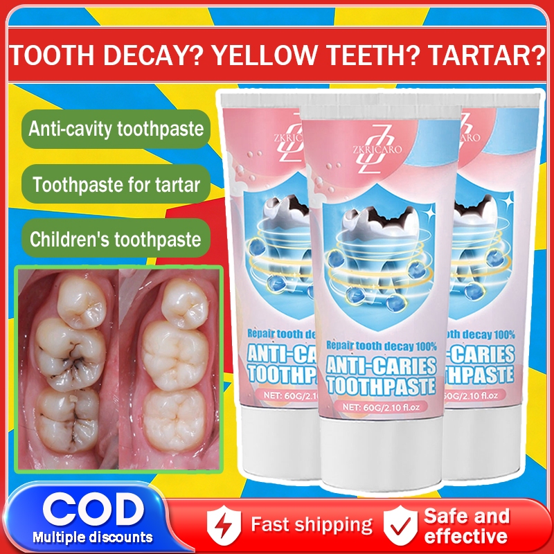 Whitening toothpaste Family Cavity Prevention Toothpaste - For Strong ...
