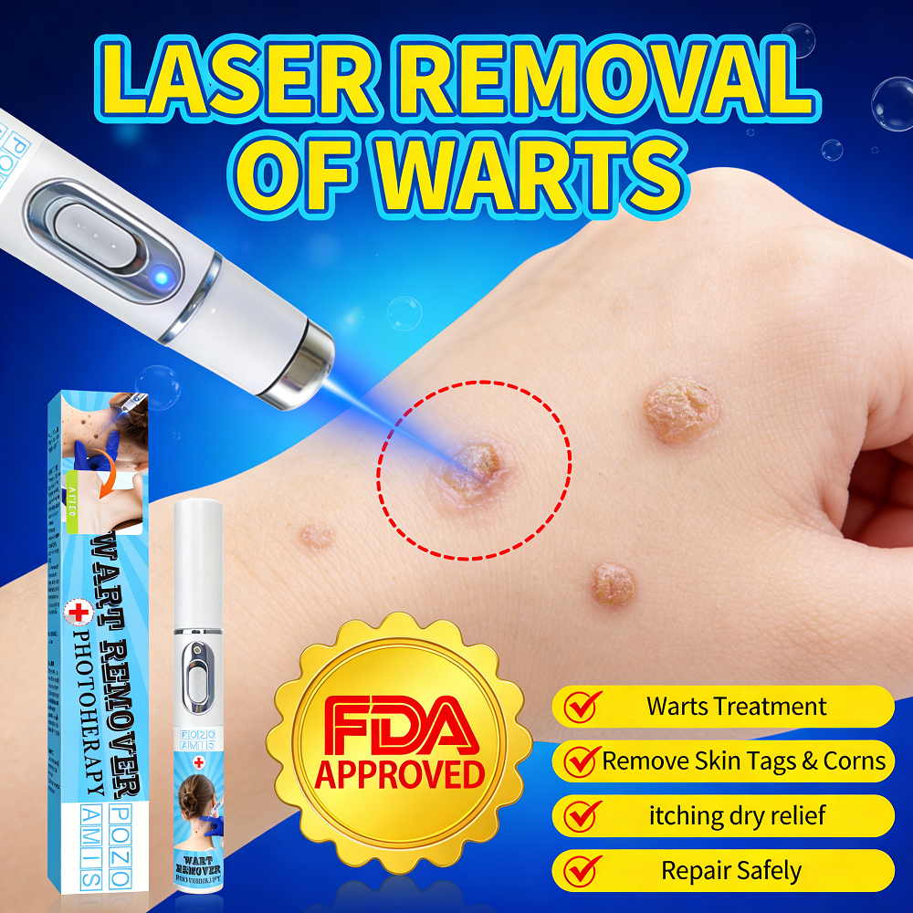 Precise laser wart removal, covering all types of warts (flat warts ...