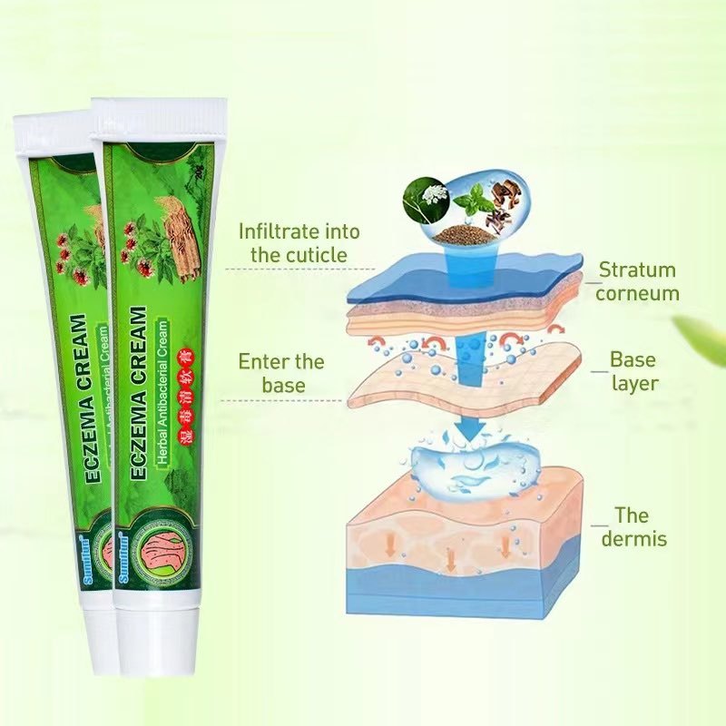 Shop gamot sa kati kati ointment for Sale on Shopee Philippines