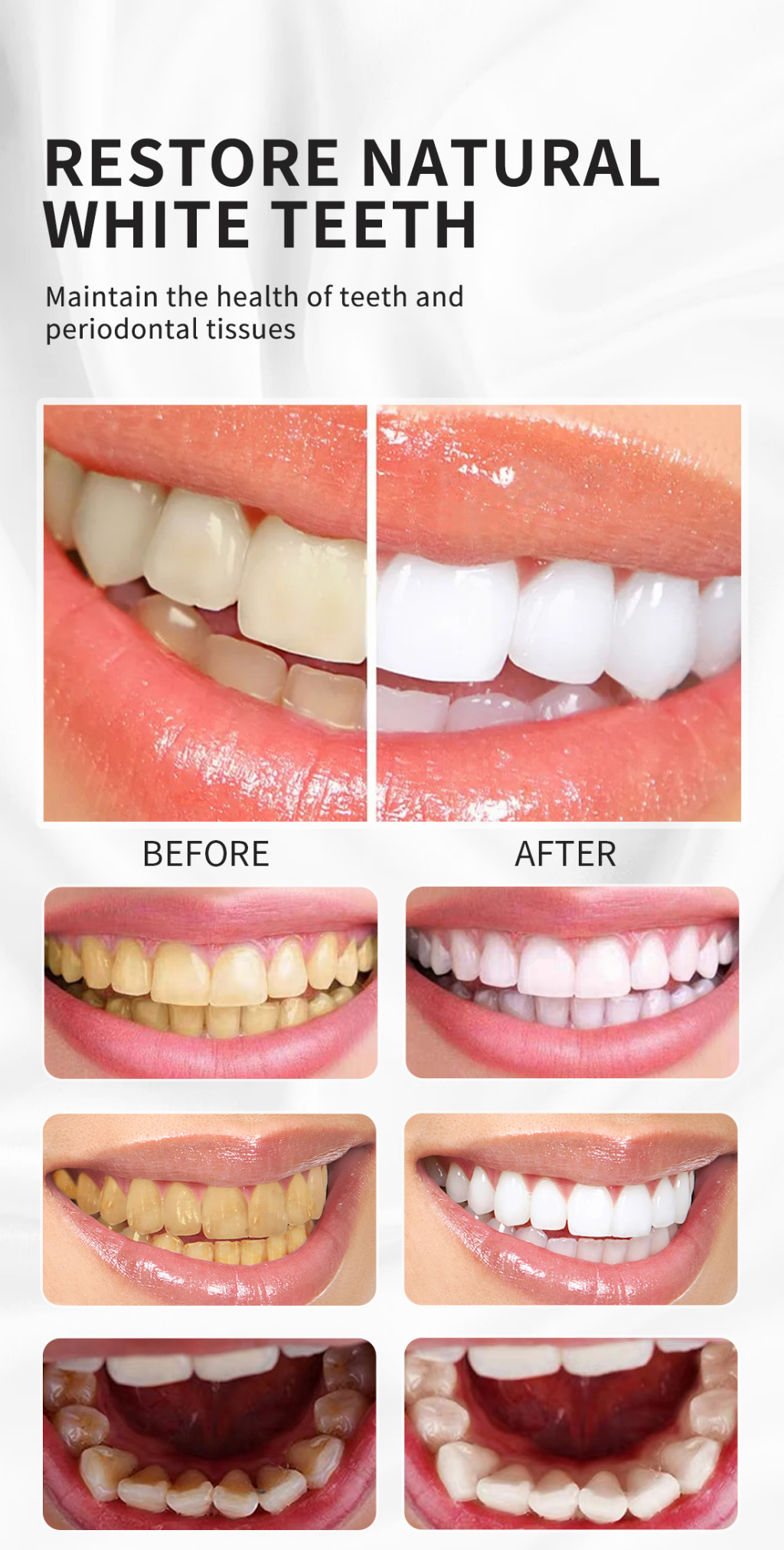 RtopR Teeth Cleansing Whitening Mousse Removes Stains Oral Hygiene ...