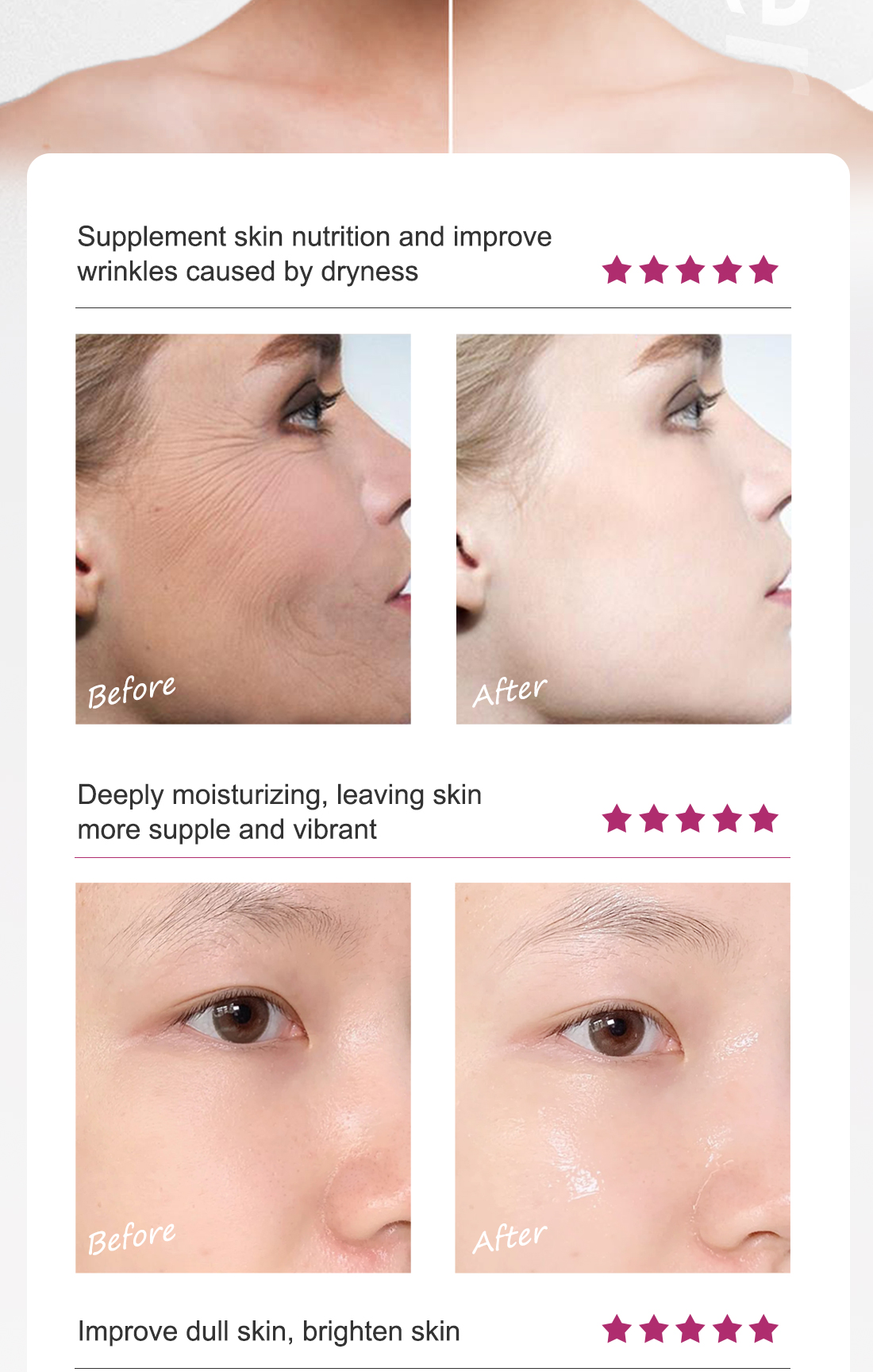 RtopR FDA Hyaluronic Acid Collagen Face Serum Acne Treatment Anti