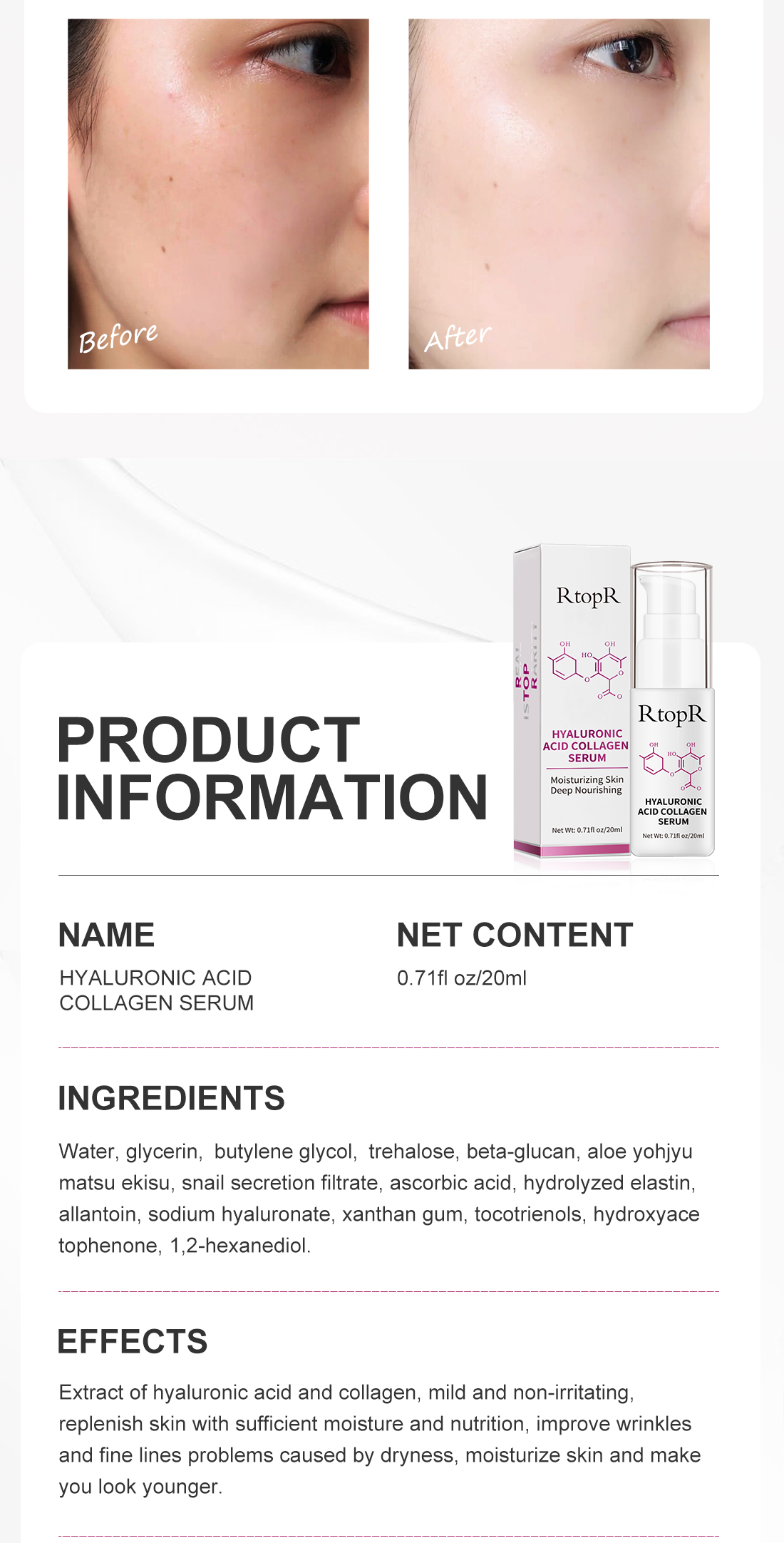 RtopR FDA Hyaluronic Acid Collagen Face Serum Acne Treatment Anti
