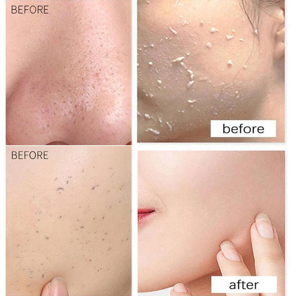 Body Scrub Exfoliating Gel Rubbing Mud Remove Dead Skin Deep Cleansing ...