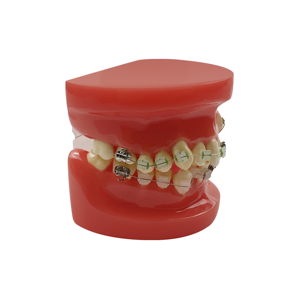 Dental Model Crowding Teeth Treatment Standard Teaching Model Dental ...