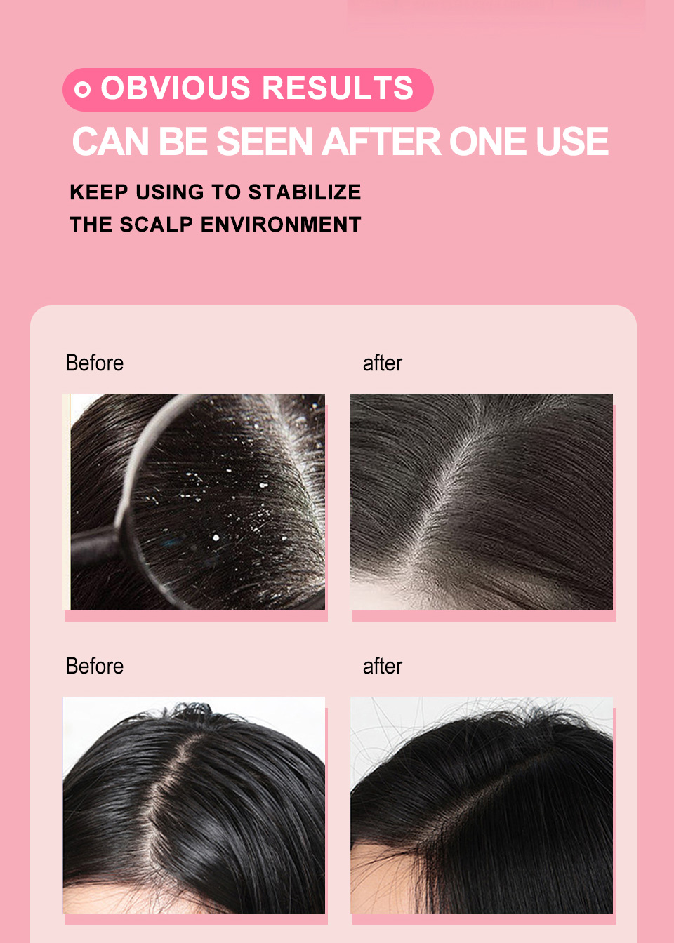 SEVICH Apple Puree Shampoo Sea Salt Shampoo Hair Treatment Scrub Hair ...