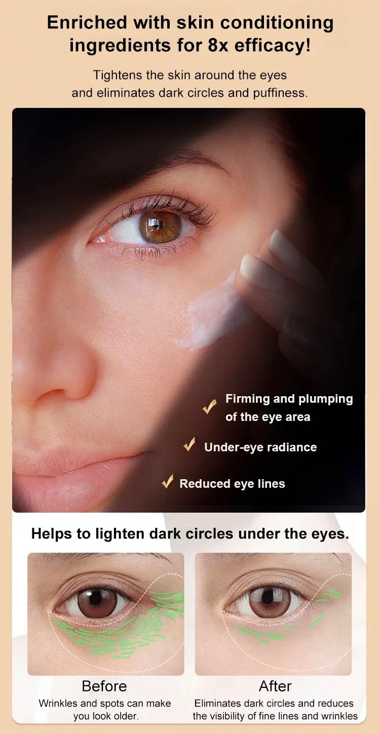 Celyn Instant Firming Eye Serum Eye Cream30ml Removes Eye Bags Fade ...