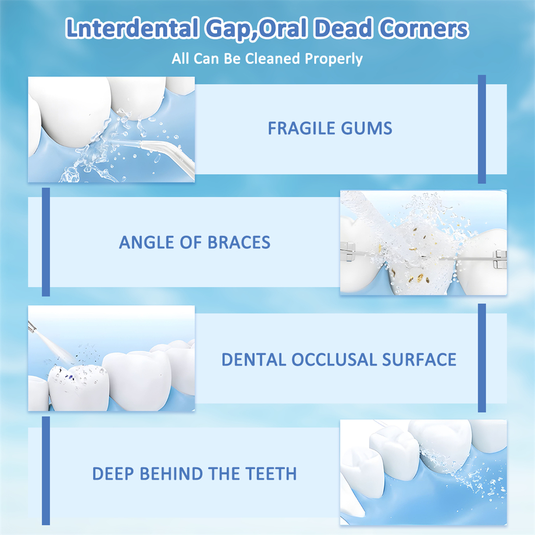 CkeyiN Oral Care Water Flosser Portable Water Floss Oral Irrigator ...
