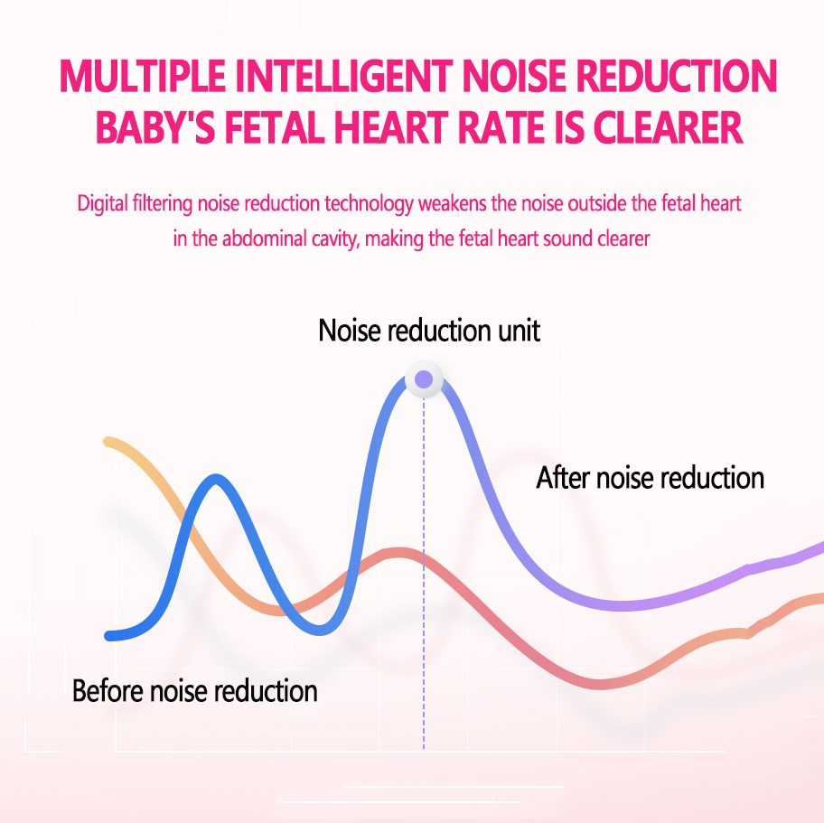 OUMRO Fetal Doppler Ultrasound Baby Heart Monitor with Gel 250ml ...