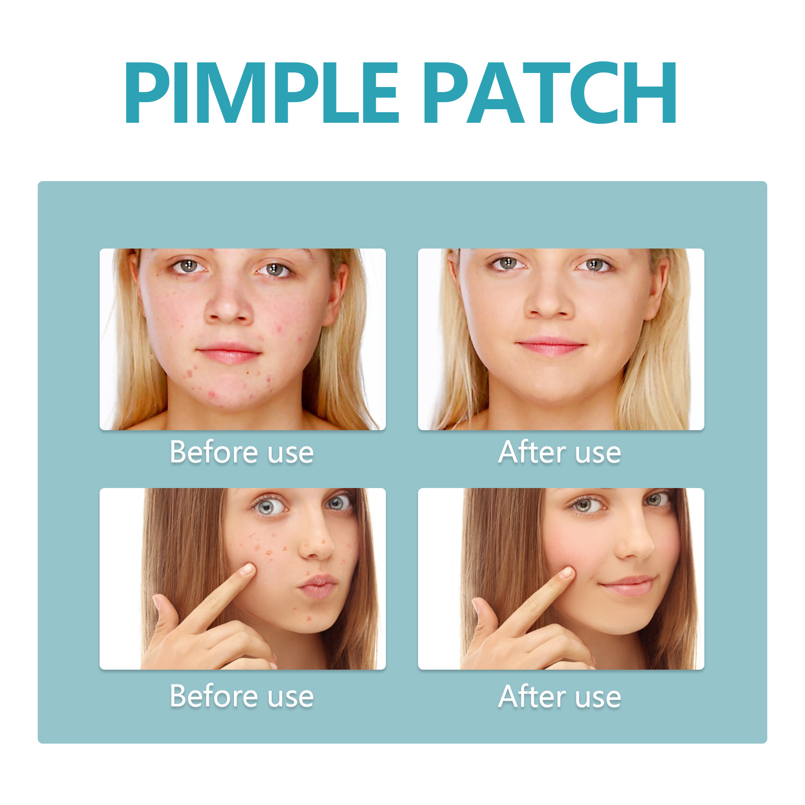 West&Month Pimple Patch Repair Acne Pimples Clean Invisibility ...