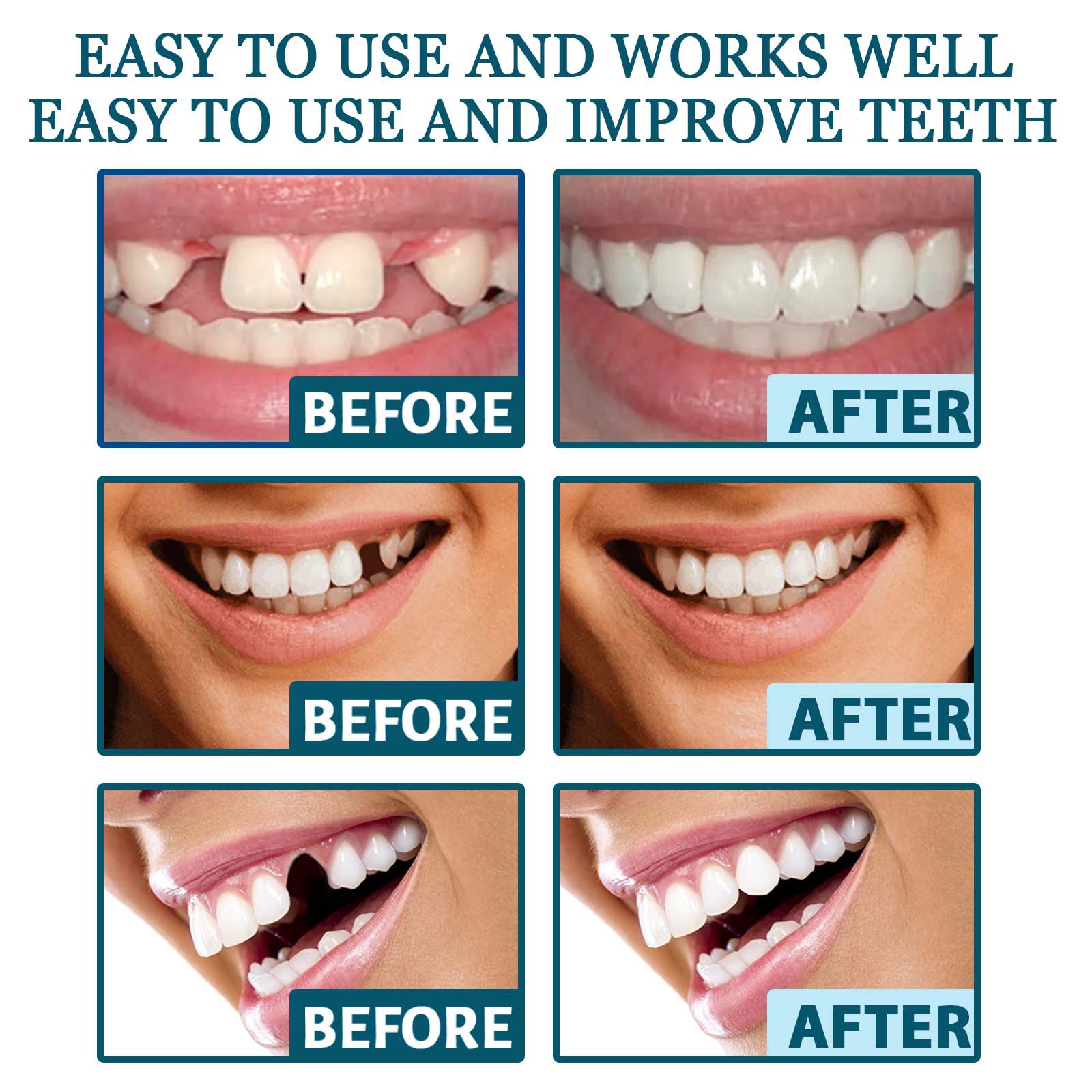 EELHOE adjustable snapon dentures to modify teeth complete teeth and