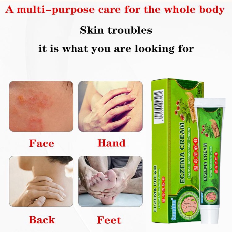 Eczema Cream Dermatitis gamot sa kati sa balat Ointment for Itchy Skin ...
