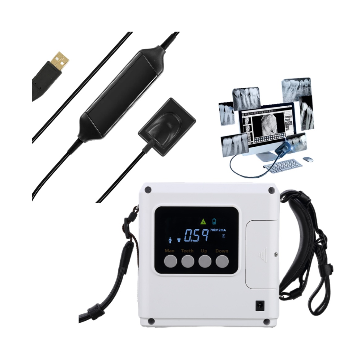 Runyes PortableX Ray Machine with Rvg Xray Sensor 70 KV/2mA Digital ...