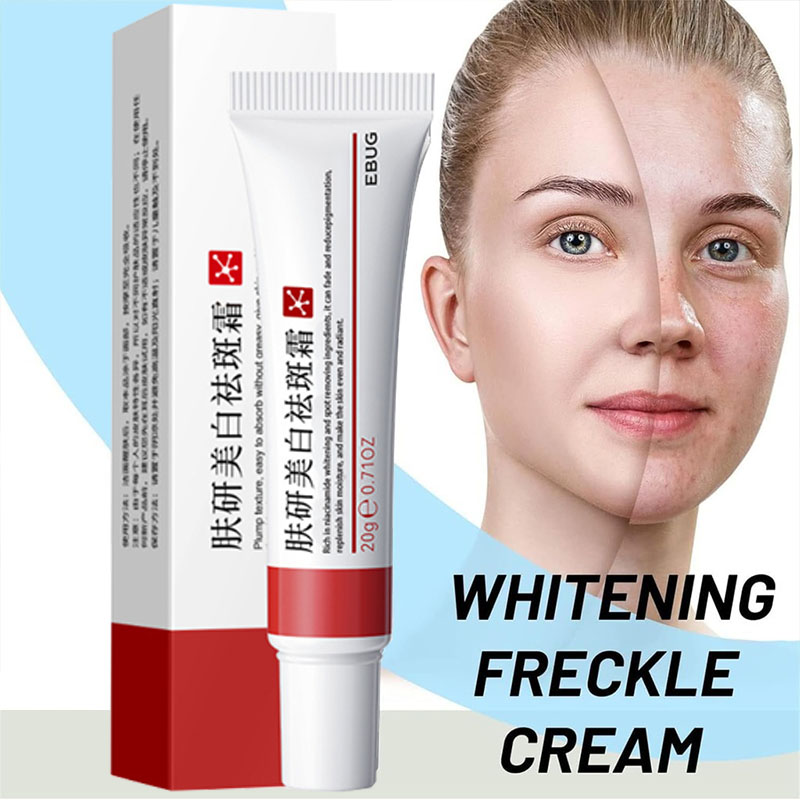 20g Freckle Cream for Face, Melasma Dark Spots Wrinkles Blemishes ...