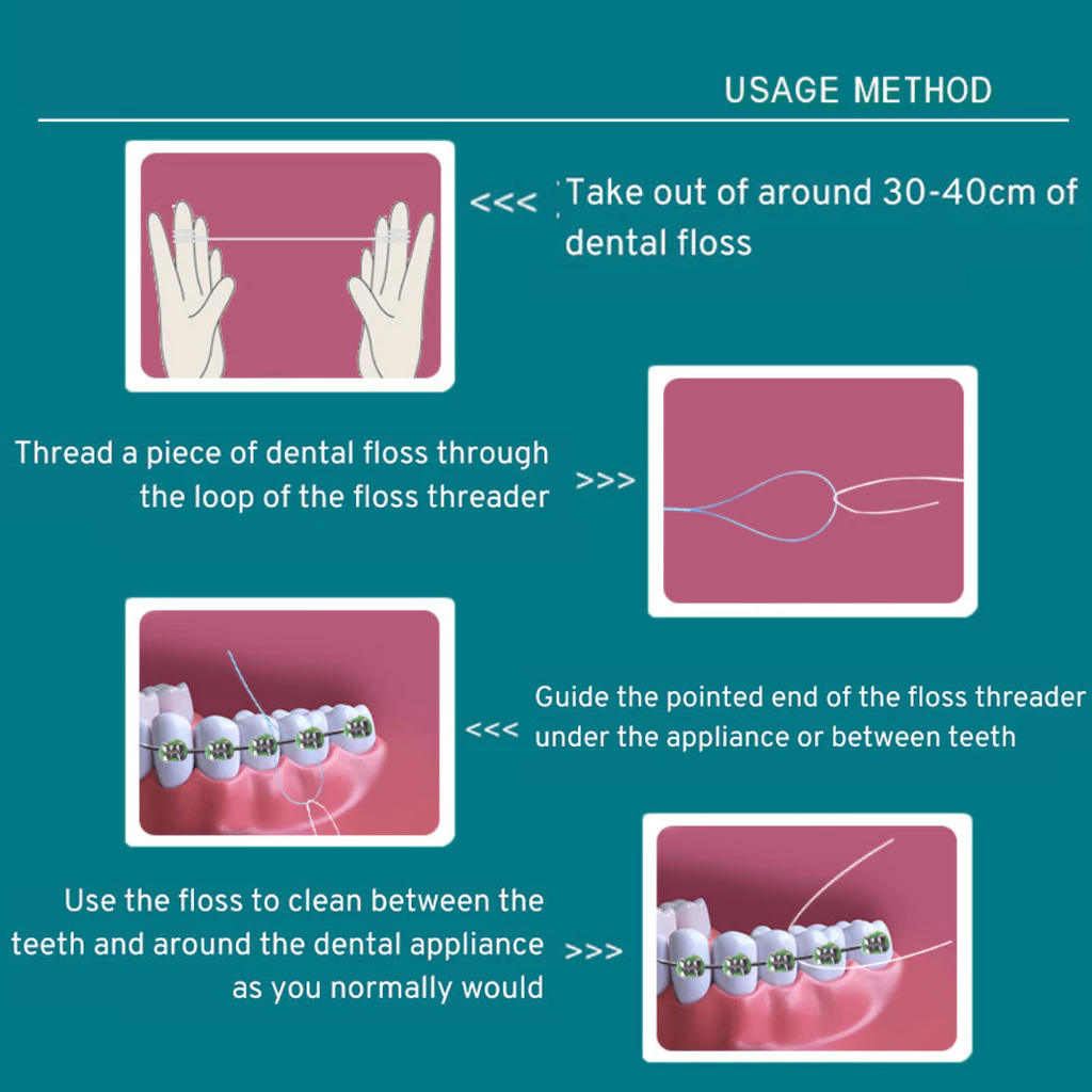 70ct Dental Floss Threaders for Braces Bridges Implants | Shopee ...