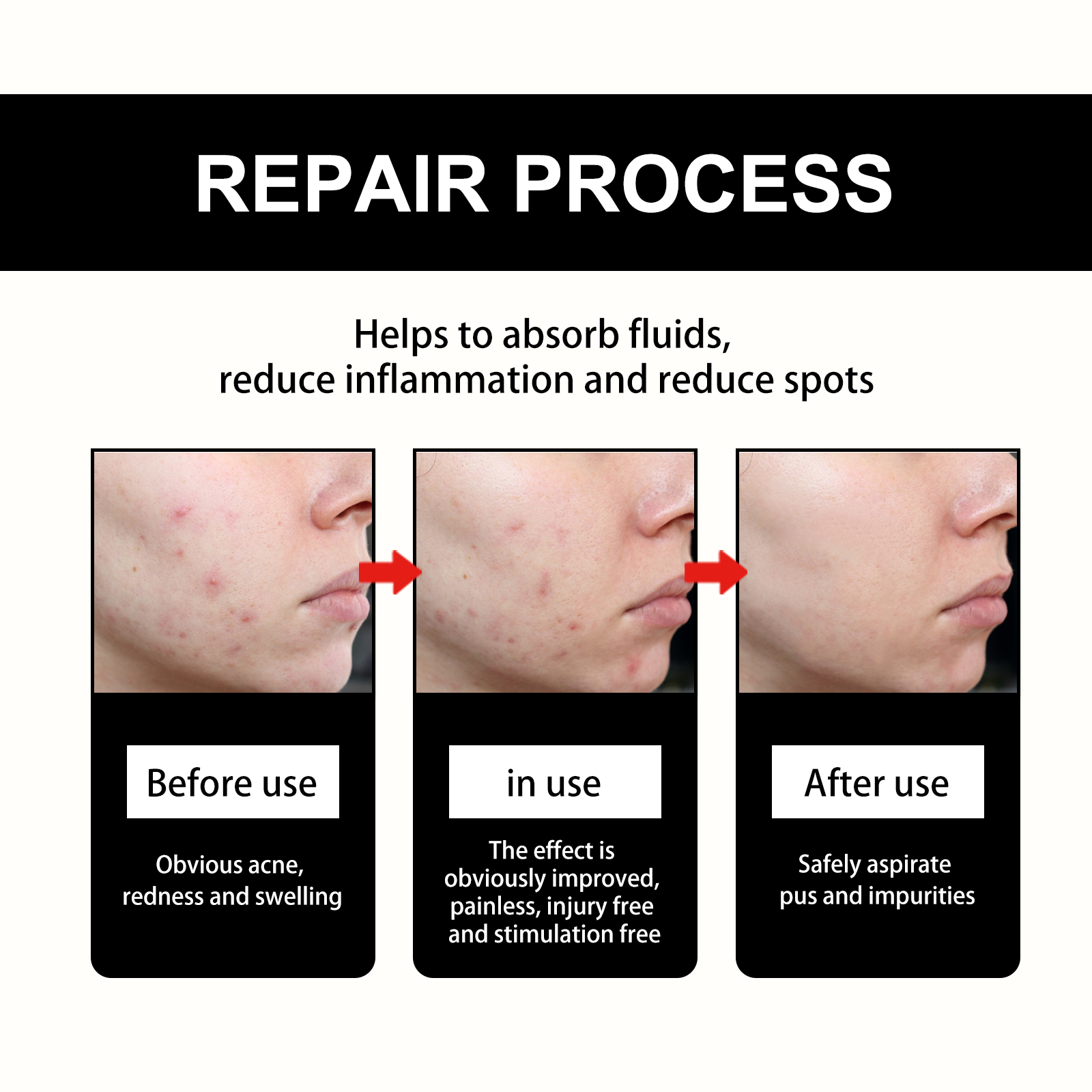 Acne Pimple Patch Waterproof Acne Cover Treatment Healing Pimple Remove ...