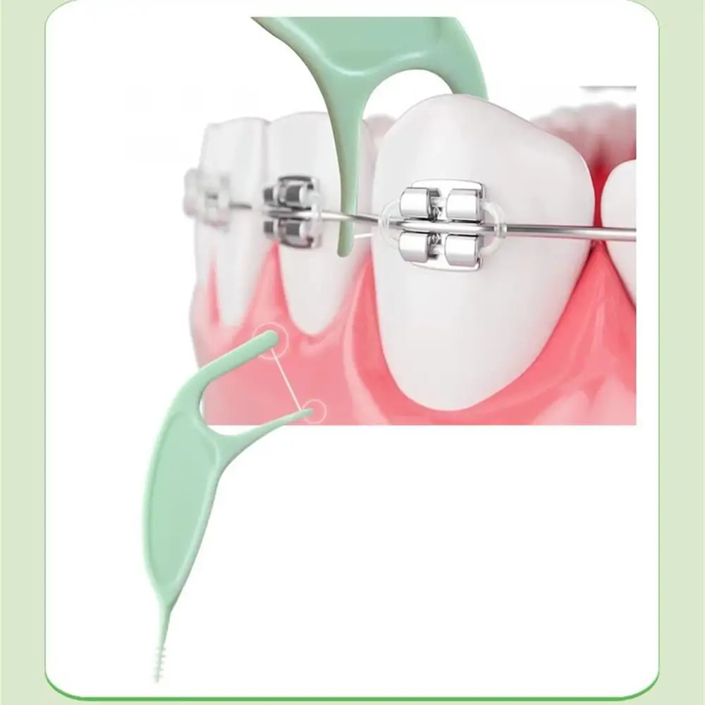 Dental Floss Threaders for Braces - Single-Use Orthodontic Cleaners ...