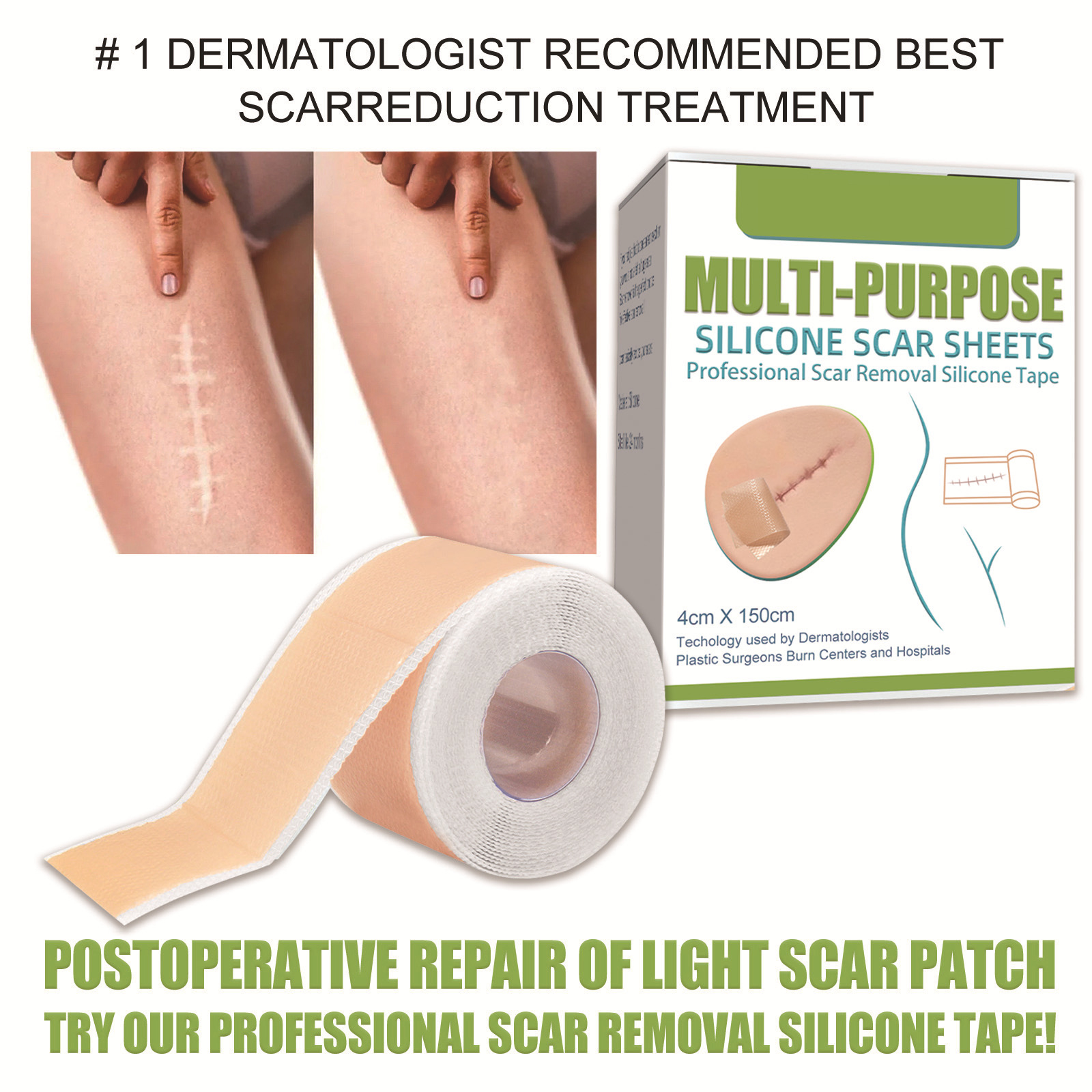 ⭐Local Warehouse+COD⭐ Silicone Gel Strips Patch Silicone Scar Sheets ...