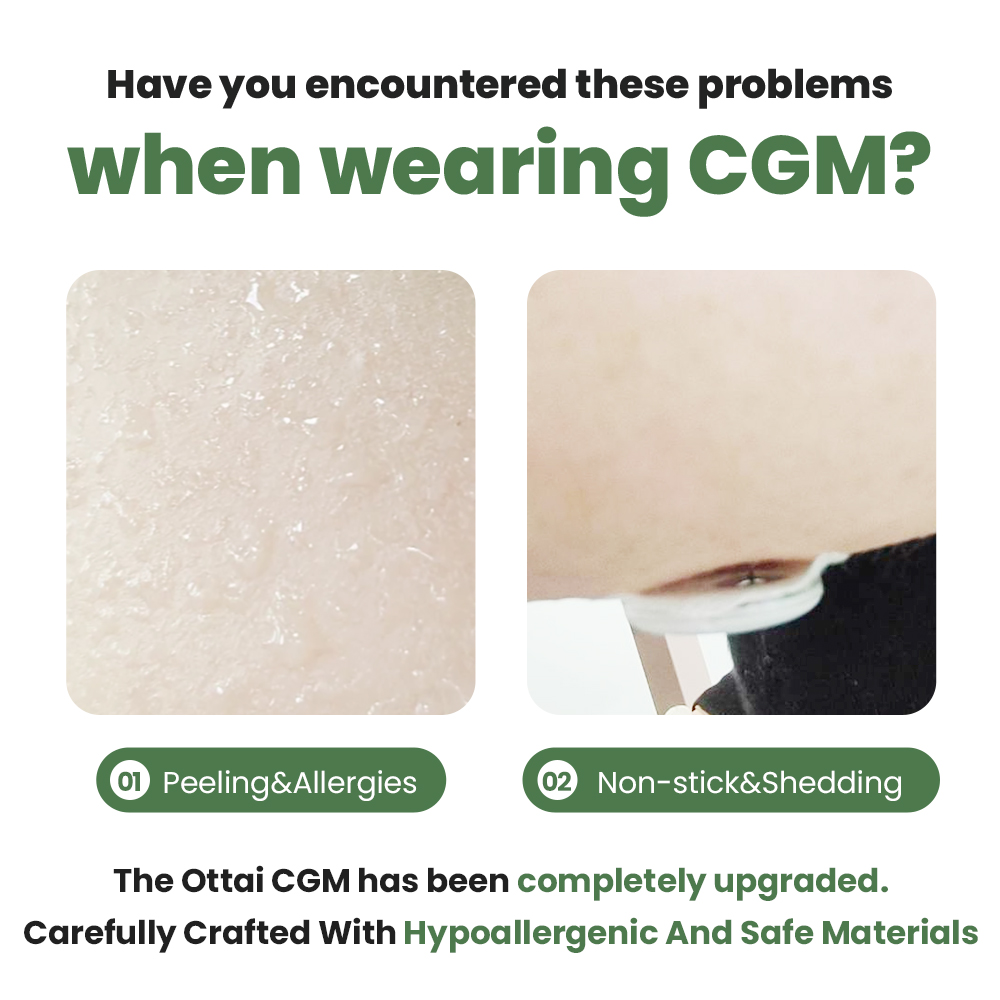 Understanding CGM Sensors and How They Work - Tandem Diabetes
