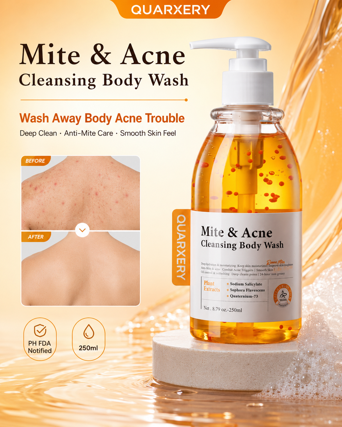 【Original】QUARXERY Anti-Mite & Body Acne Wash 250ml | Salicylic Acid ...