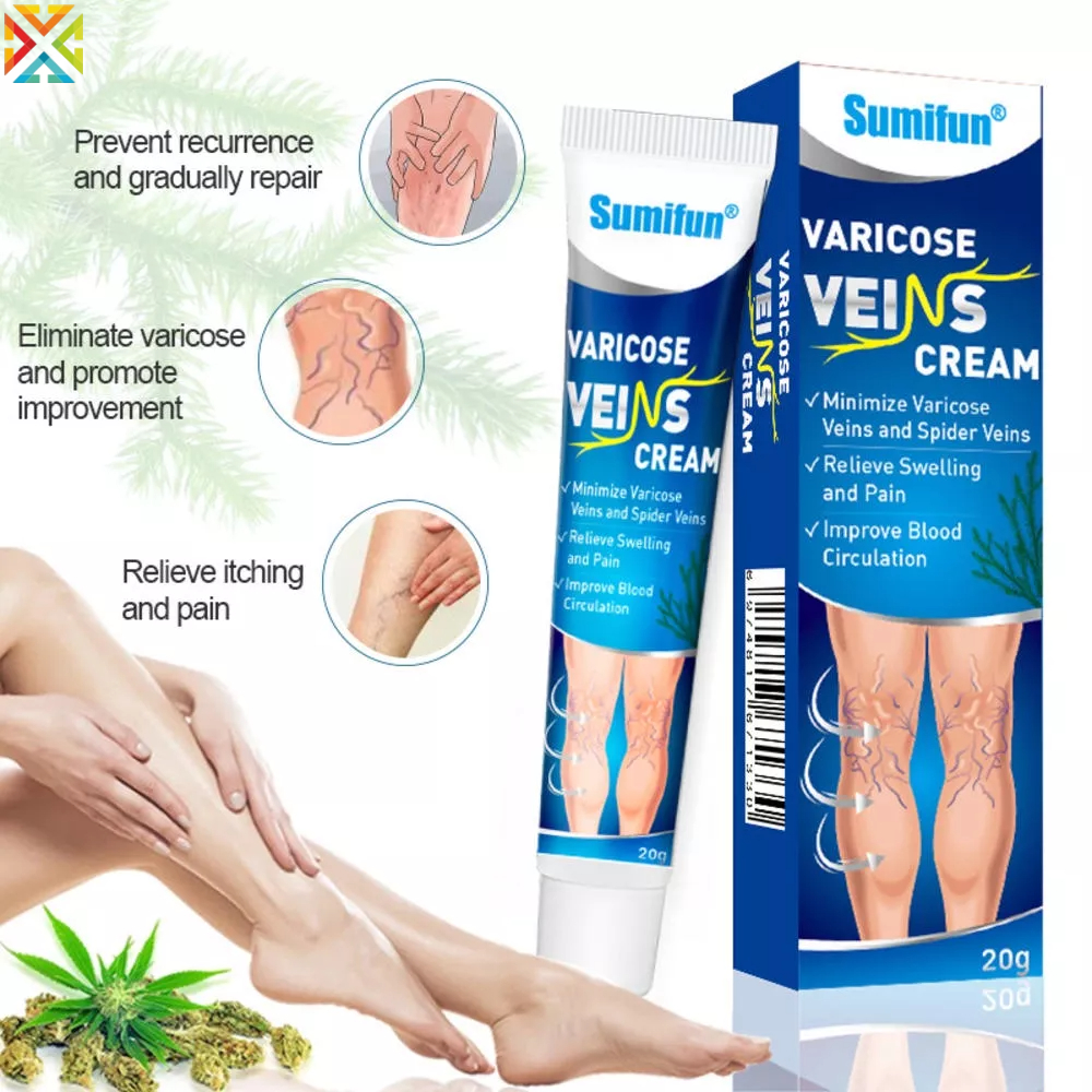 20g Varicose Vein Cream Blood Vessel Swelling Leg Raised Vasculitis Phlebitis Effective
