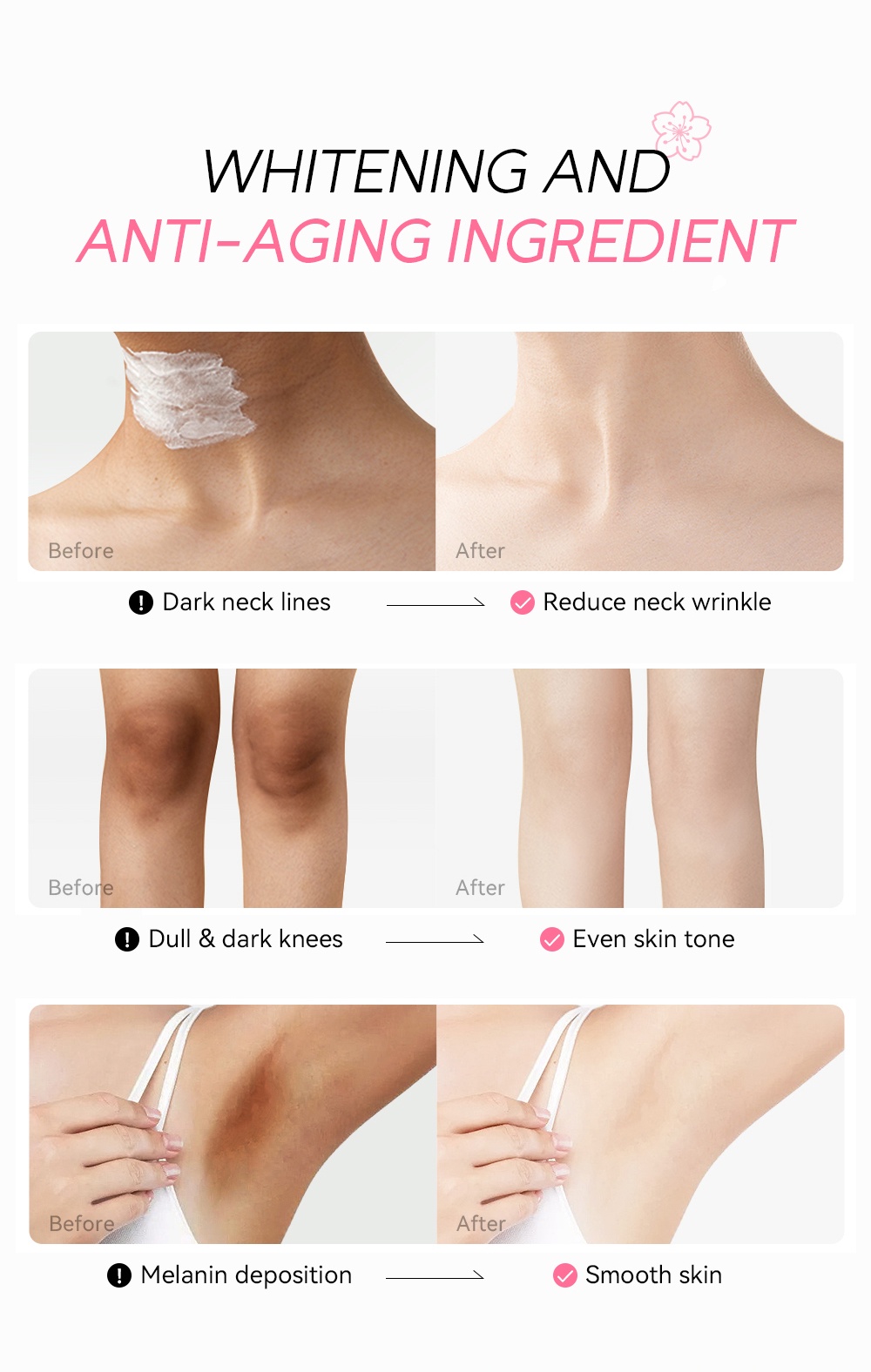 Sakura Underarm Whitening Cream Price In Bangladesh & Guaranteed  Authenticity