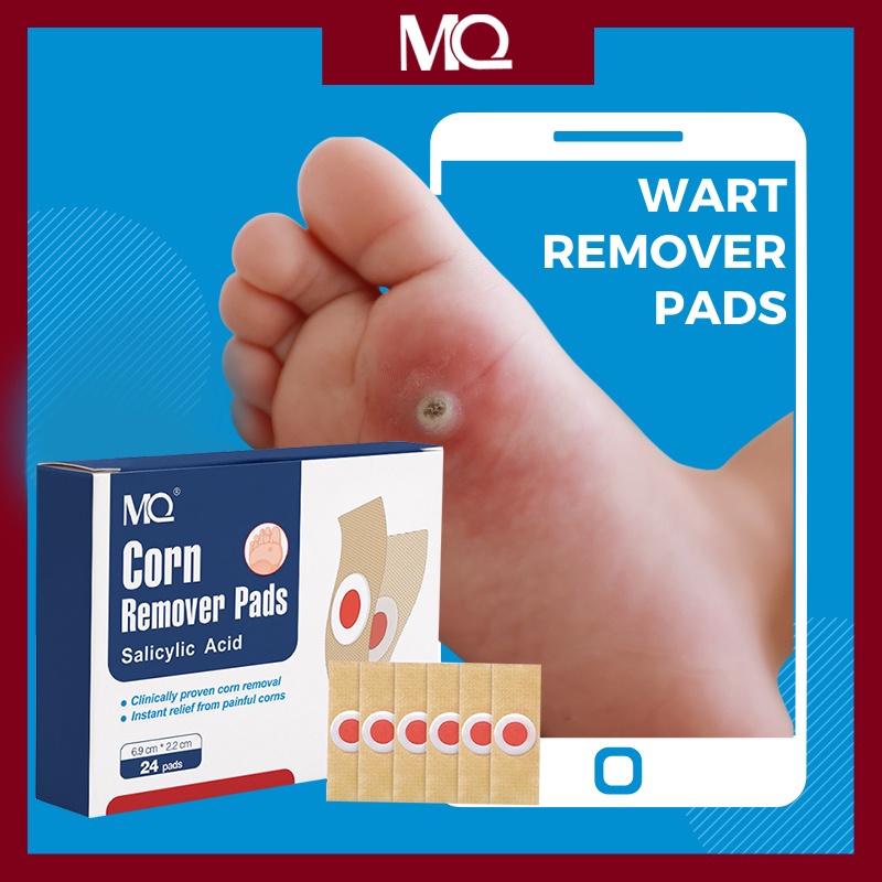 corn remover for feetl callus remover foot care foot pads calluses ...