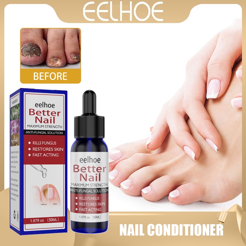 EELHOE Nail Drop Liquid Fungus Therapy Best Repair Stop Fungal Growth ...