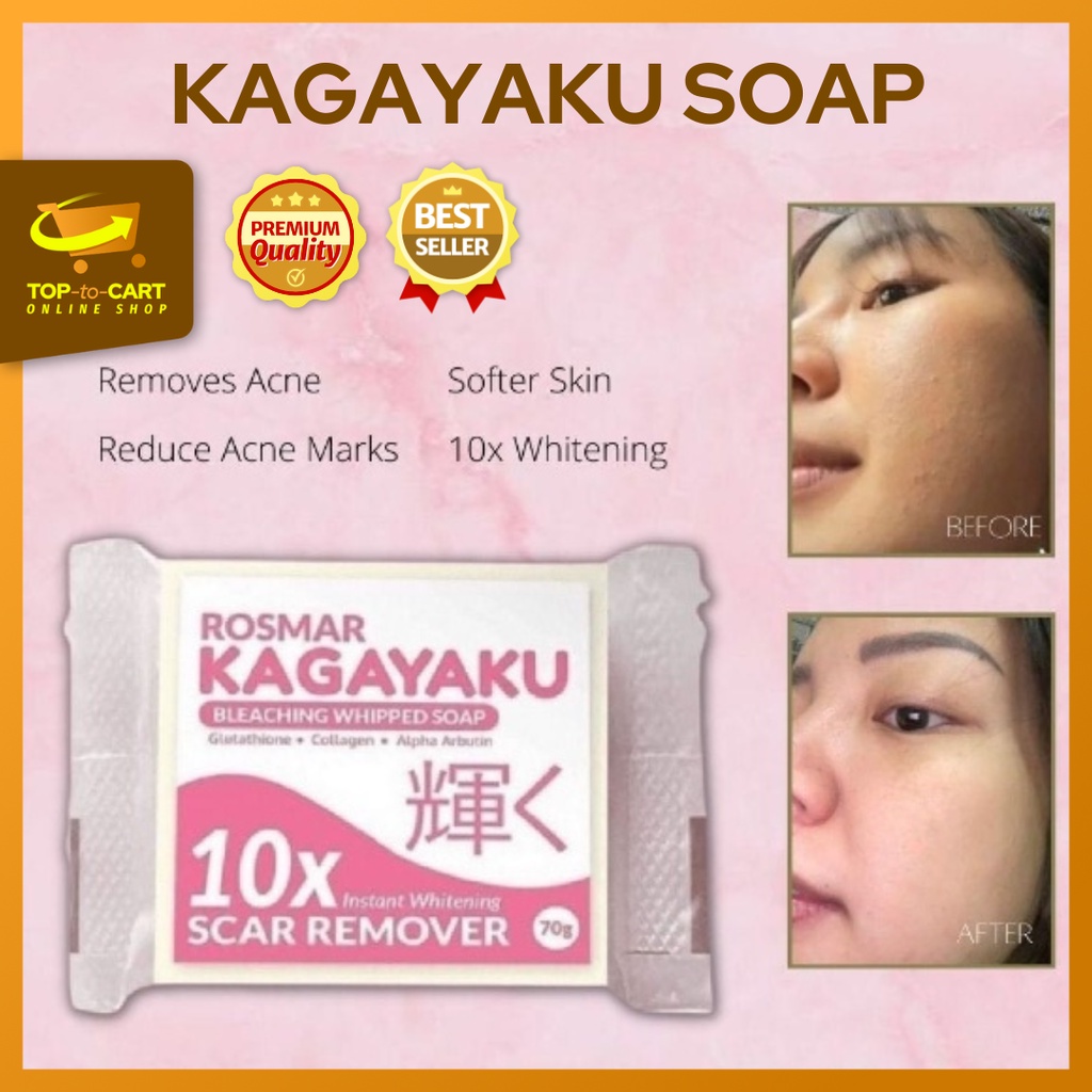 Effective Kagayaku 1 Bar Soap Scar Remover 10x Whitening Soap Rosmar