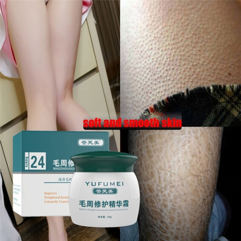 50g Keratosis Pilaris Cream Body Lotion Skin Repair Cream Skin Care