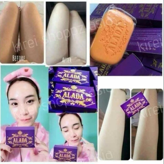 alada whitening soap | Shopee Philippines