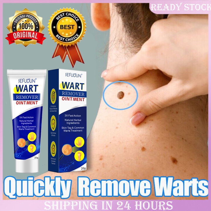 SEFUDUN Original Painless Warts Remover Ointment Cream Effectively