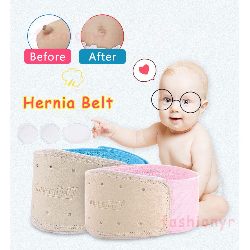 Infant umbilical hernia clearance belt