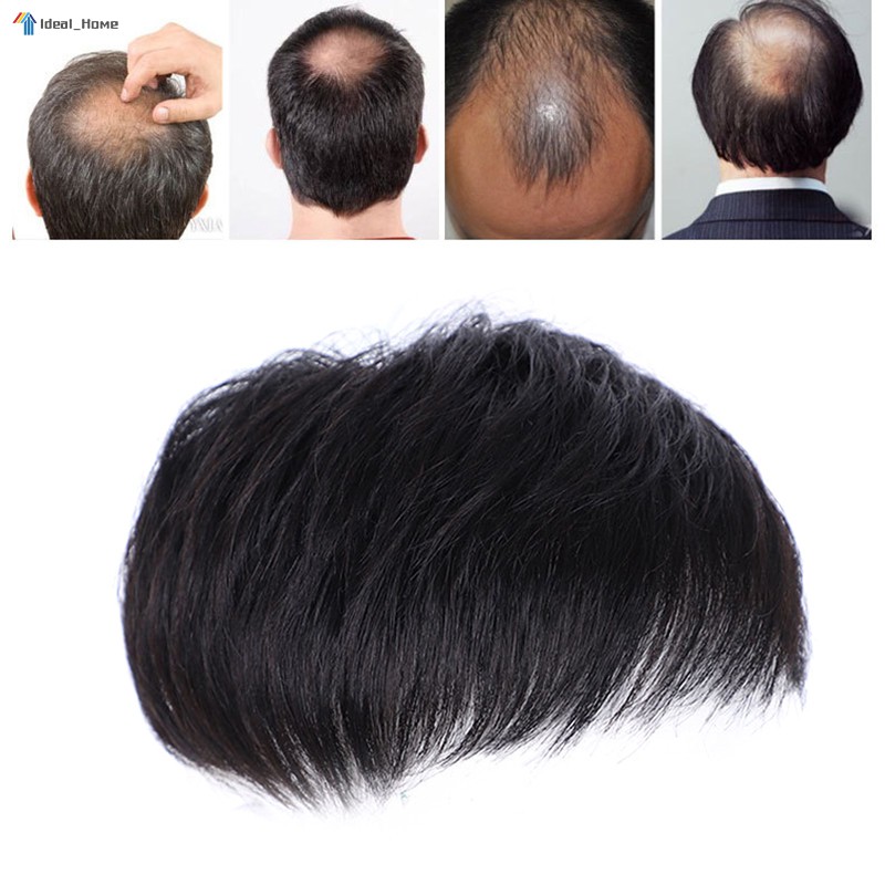Toupee lazada new arrivals