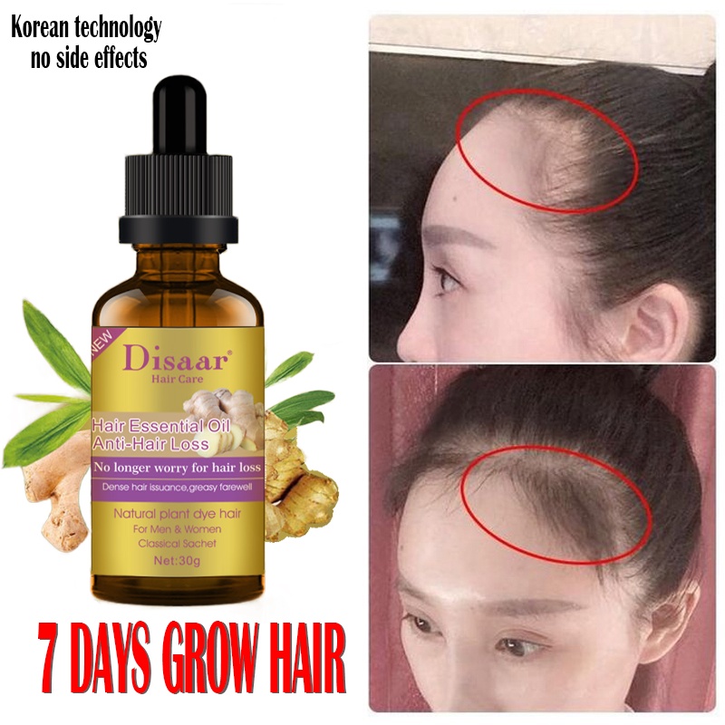 Ginger Hair growth Essence Hair Anti-Lose Essential Oil Hair Grower ...