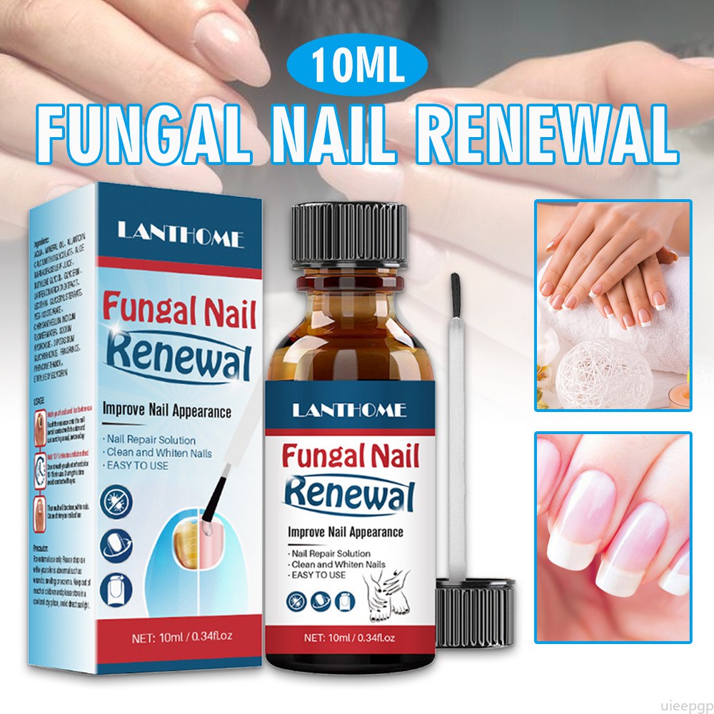 10ml Fungal Nail Renewal Extra Strength Nail Fungus Treatment Liquid 