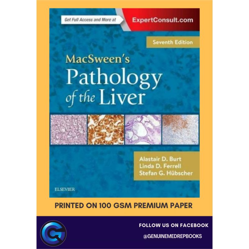 MACSWEEN'S PATHOLOGY OF THE LIVER 7TH EDITION | Shopee Philippines