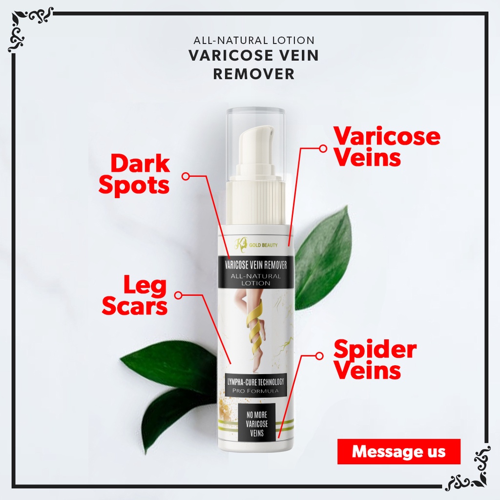 KGOLD BEAUTY VARICOSE VEIN REMOVER 24K VARICOSE VEIN REMOVER by K GOLD