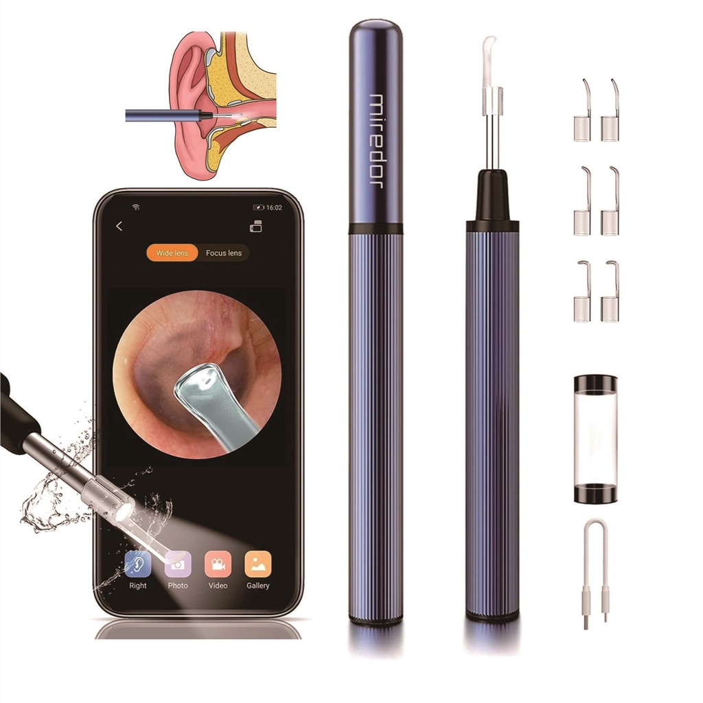 Miredor Smart Visual Ear Cleaner Otoscope With Appenable Camera 3