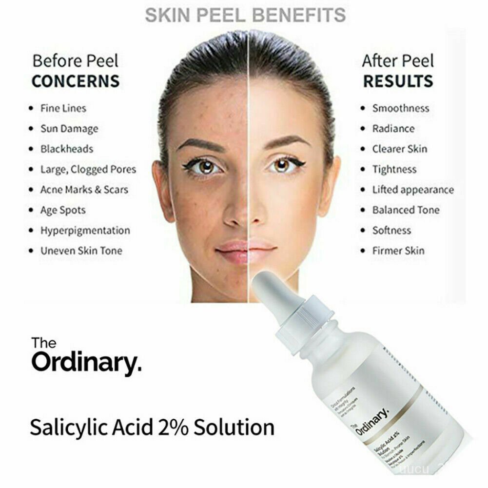 The Ordinary Salicylic Acid 2 Solution Fast Effective Skin Peel