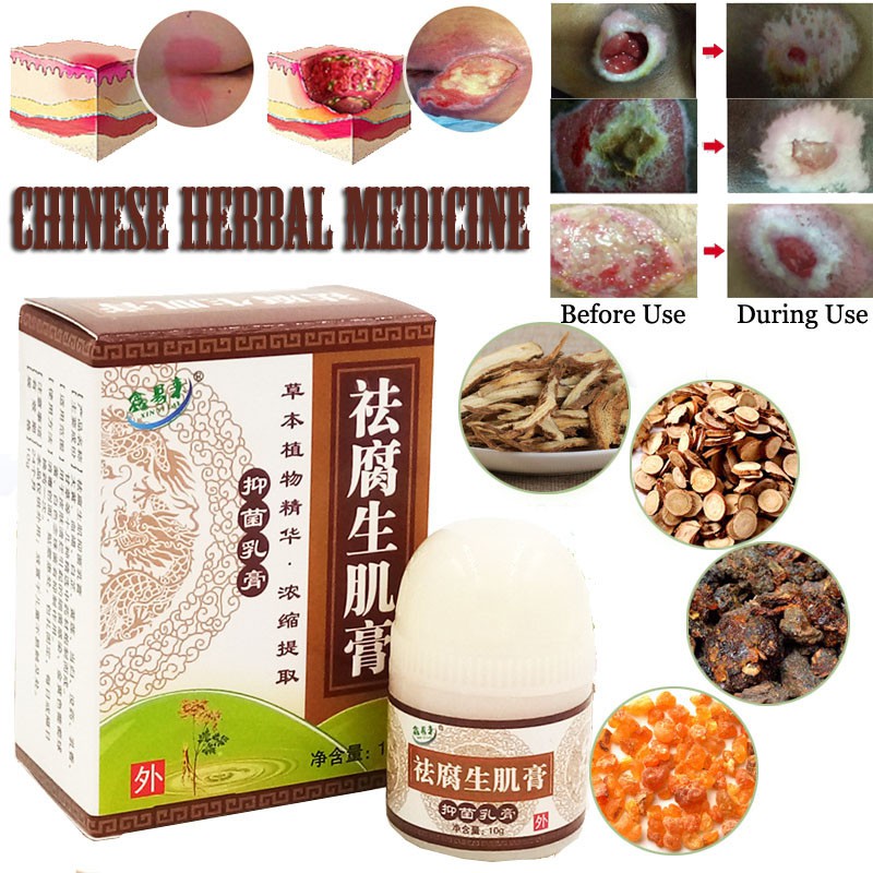1PC Herbal Removal Rot Myogenic Cream Bedsores Paste Treat Pressure ...