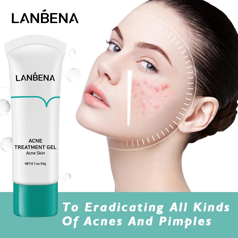 LANBENA Acne Treatment Gel Acne Cleaning Cream 20g | Shopee Philippines