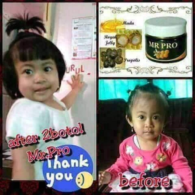 MrPRO Complete Multivitamin Honey | Shopee Philippines
