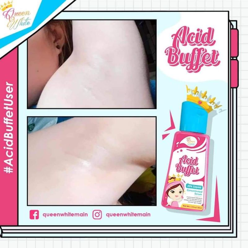 QUEEN WHITE ACID BUFFET(Underarm Whitening) | Shopee Philippines