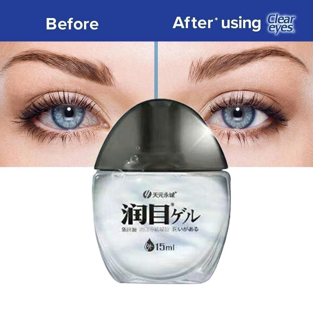 Cod Liver Oil Eye Drops Relax Cleaning Relieves Eyeball Red Drops Eyes