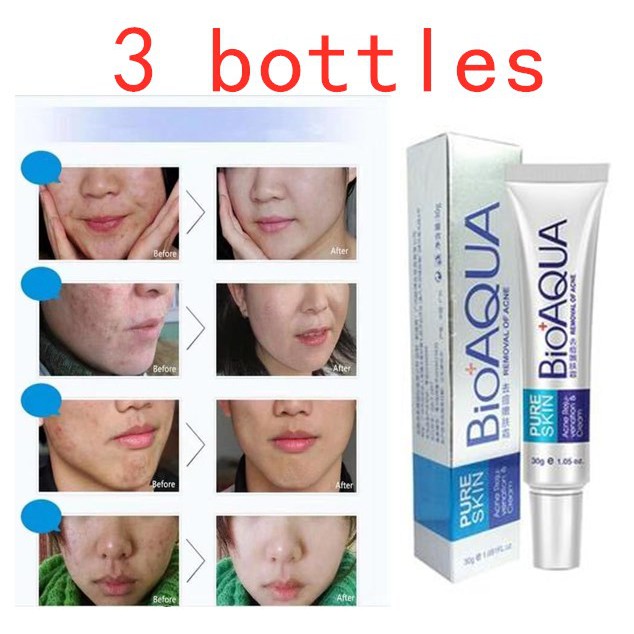 3 bottles BIOAOUA Pure Skin Anti Acne CREAM 30g | Shopee Philippines